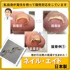 Nail Aid 0.6 inch (16 mm) Winding Nail Correction Self-Winding