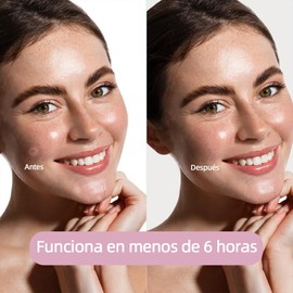 PKDEF Parches para Acne, 400 Almohadillas Hidrocoloides para Espinillas, Pimple Reduce Enrojecimiento,Pimple Patch Múltiples formas, Pueden Absorber la Secreción，Para Todos Los Tipos de Piel (Estrella) (Estrella)