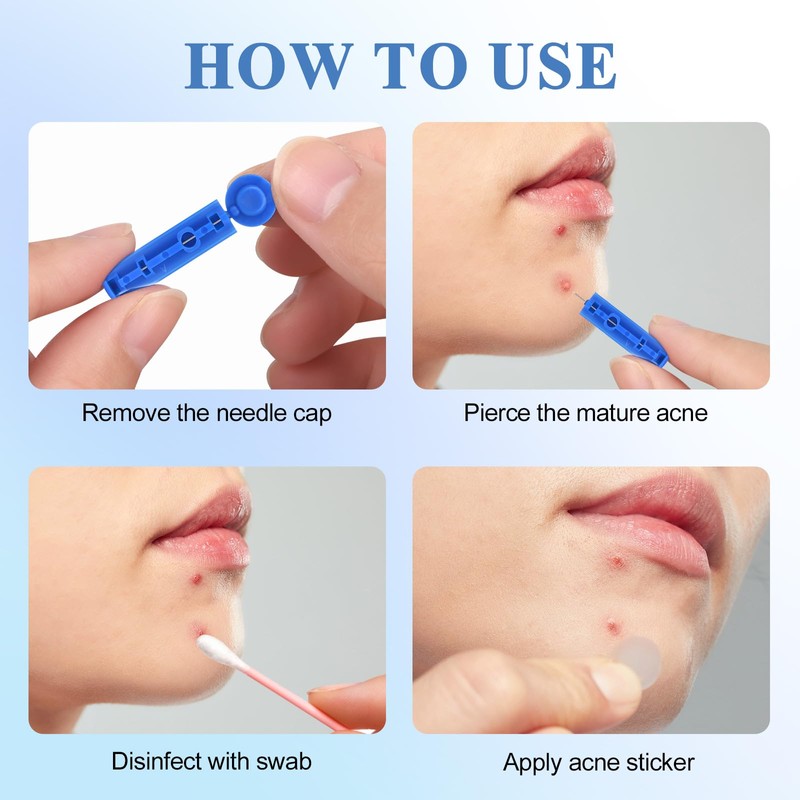 Lishae Acne Needle, 50 Pcs Disposable sterile Needles and 70