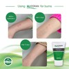 Alhydran After Care for The Skin | Scars, Dry Skin,
