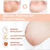 Silicone Patches for Stretch Marks, Anti Wrinkle Stretch Removal Sheet