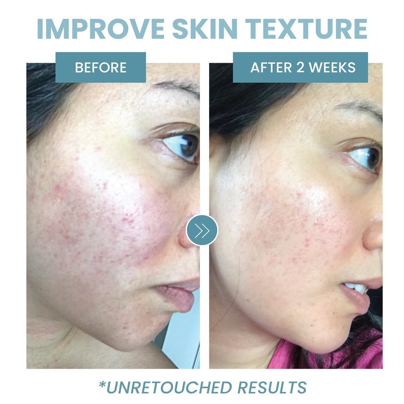 Eva Naturals Collagen Peptide Complex Face Serum by Eva Naturals