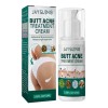 Crema Reparadora Para El Acné De Glúteos, Hidratante Para El