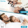Anti Snoring Nose Clip, Anti Snoring Device for Removal of