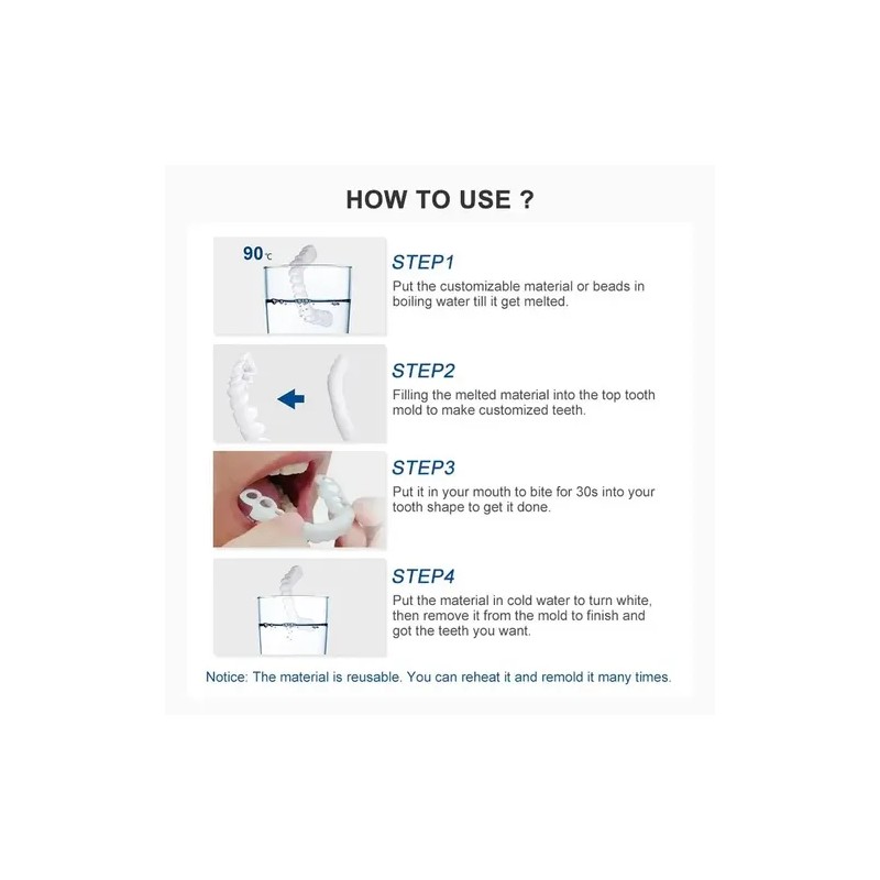 Carillas Estéticas Snap On Smile Veneers Dientes Temporales