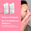 benevi Pigment Cream 20 ml for Targeted Covering Redness, Pimples,