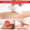 FRESINIDER 2" x 5" Pack of 10 Silicone Foam Wound