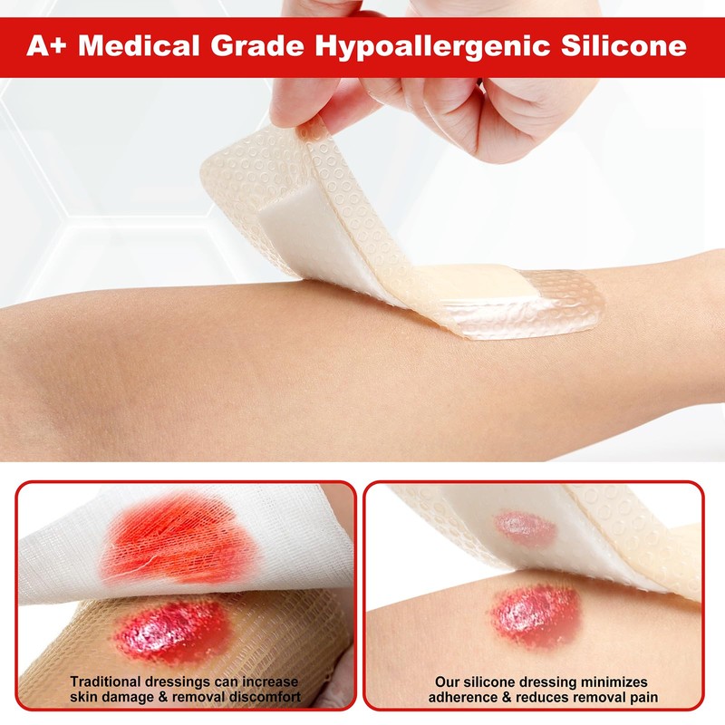FRESINIDER 2" x 5" Pack of 10 Silicone Foam Wound