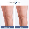Vitamin K Cream- Moisturizing Bruise Healing Formula. Dark Spot Corrector