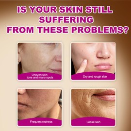 Arbutin 7% + Tranexamic Acid 4% Cream, Dark Spot Corrector Face Cream with Niacinamide & Hyaluronic Acid, Gentle Skin Brightening Korean Moisturiser, Targets Hyperpigmentation, Melasma,Even Skin Tone