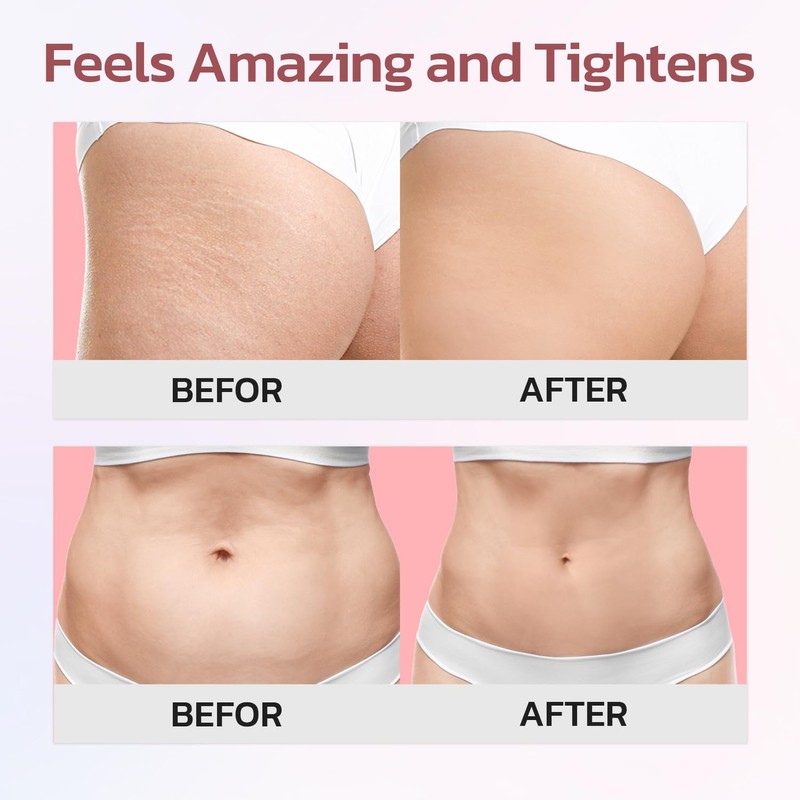 MythosFlow Cellulite Cream, Butt Firming and Lifting Cream - Reduce