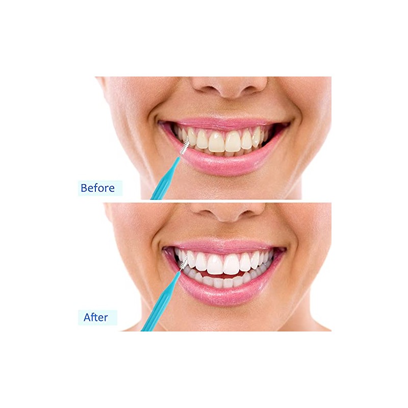 100 piezas de cepillos para limpiador, cepillo interdental, palillo de