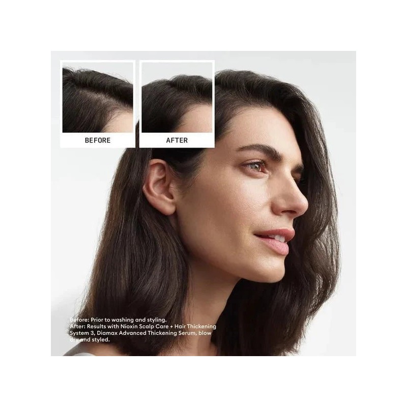 Nioxin Scalp + Hair Thickening System 3 Trial Kit