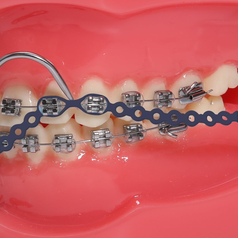 faruijie Colourful Elastic Power Chain for Braces Dental Orthodontic Powerchains