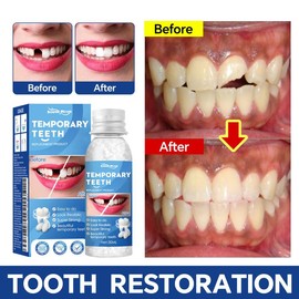 Resin Teeth Repair Glue – Moldable Temporary Tooth Filling & Broken Tooth Repair | Safe & Easy-to-Use Dental Gel for Gaps, False Teeth & Denture Fixing:_1pcs