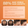 BosleyMD BosRevive Color-Safe Hair Care Kit for Thinning Hair, Starter