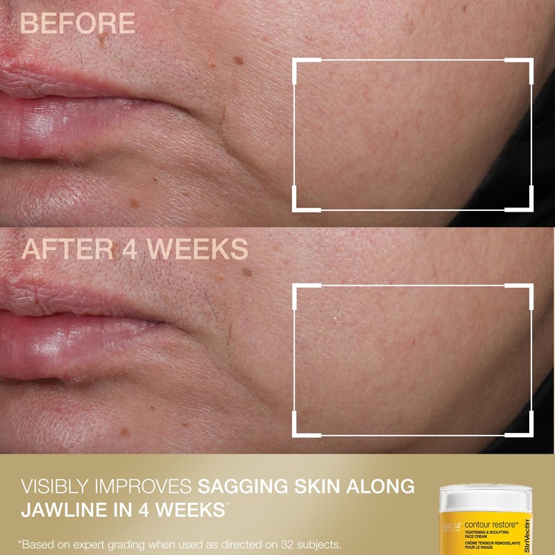 StriVectin Contour & Tighten Lifting Duo: TL Advanced Neck Cream