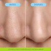 Bioré, Mascarilla Nasal Burbujeante, Perfeccionadora de Poros, Con Ácido Glicólico