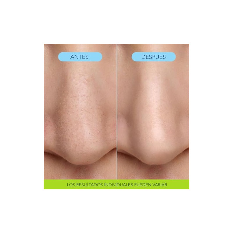 Bioré, Mascarilla Nasal Burbujeante, Perfeccionadora de Poros, Con Ácido Glicólico