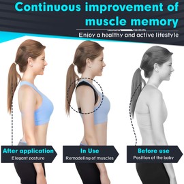 Rücken Geradehalter,Rückengurt Haltungskorrektur Rücken Damen Rückenstützgürtel für Schultergurt Haltungskorrektur Gerader Rücken Geradehalter für Verhindert Effektiv Buckel,Lindert Rückenschmerzen