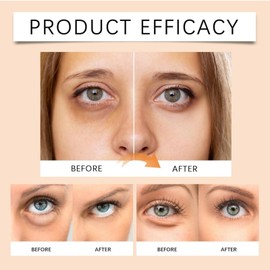 Turmeric Eye Cream,Dark Circle Eye Cream,Anti Wrinkle E-ye Cre-am,Turmeric Serum For Face,Retinol Serum Anti Aging,Reduces Fine Lines, For Dull E-ye Skin,Turm-eric Balm For Radiant&Glowing Skin