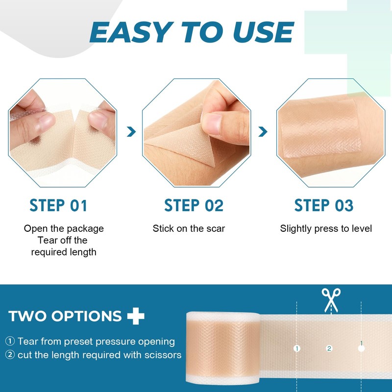 Silicone Scar Sheets, Silicone Scar Tape(1.6”x 60” Roll-1.5M), Silicone Scar