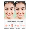 Parche Hidrocoloide Para Acné, 360 Unidades, 4 Tamaños, Cara