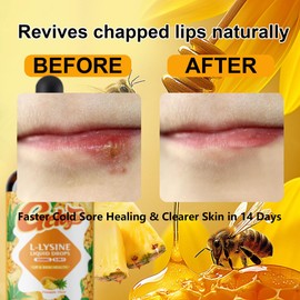 Geloyar L-Lysine Liquid Drops – Immune* & Lip Health Support | Bee Propolis, Vitamin C & Zinc | 1200mg Lysine for Cold Sore* & Skin Wellness* | Fast Absorption, Non-GMO, 2 Fl Oz