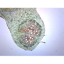 Legume Root Nodule - Prepared Microscope Slide - 75 x 25mm - Biology & Microscopy - Eisco Labs