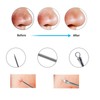 Blackhead Removal Rechargeable 5 Adjustable Suction Electric Pore Acne Cleaner