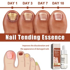 7-Day Nail Growth & Strength Serum - 20ml Nail Tending Essence For Strength, Growth, & Appearance Of Nails