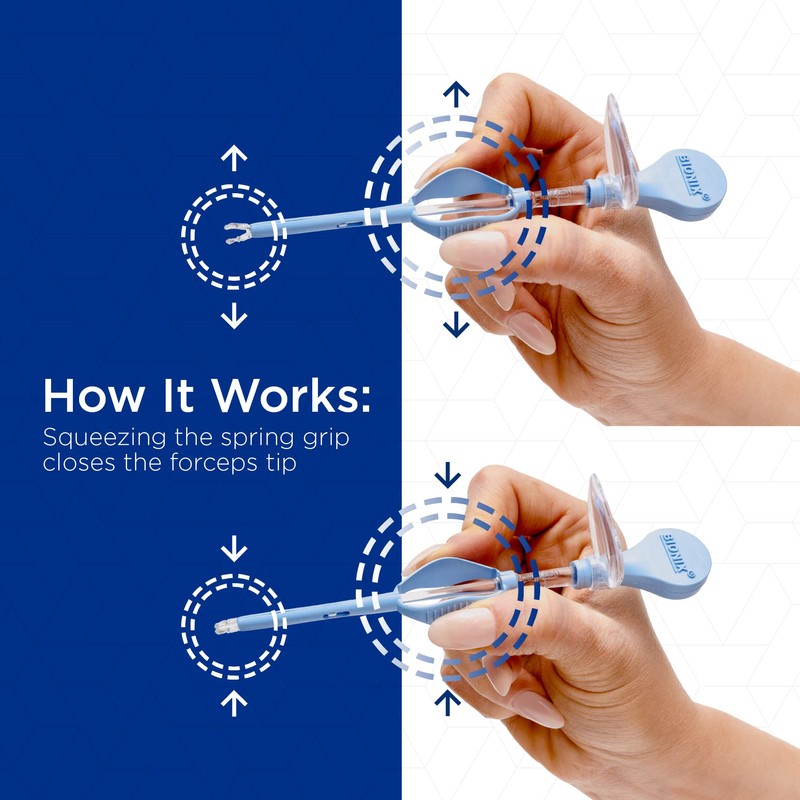 Bionix - Lighted Forceps, Foreign Object Removal Tool, Helps Remove