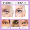 Fl Crema Reparadora Hidratante Suave For Ojos, 1 Unidad