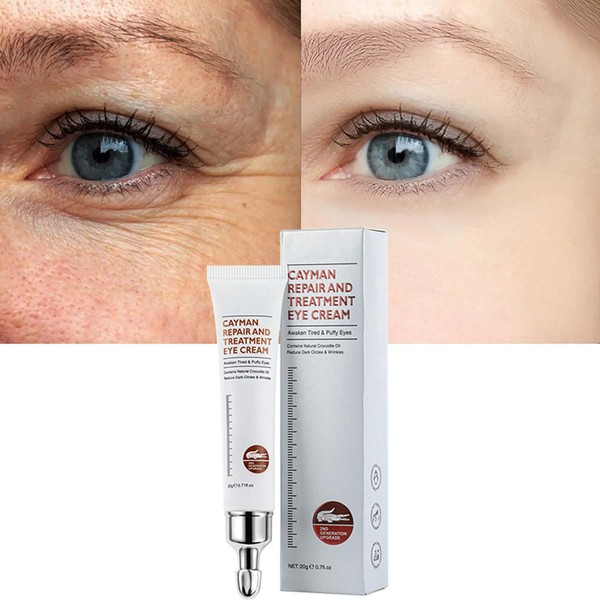 Pinnoocy Magic Eye Cream, Instantly Remove Under Eye Bags Wrinkles