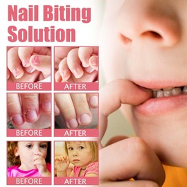 Stop Nail Biting Solution - Nail Bitter Water for Children & Adults - Clear Varnish to Discourage Thumb Sucking - Helps Break the Habit of Biting Nails