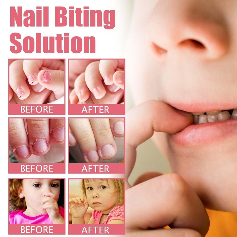 Stop Nail Biting Solution - Nail Bitter Water for Children