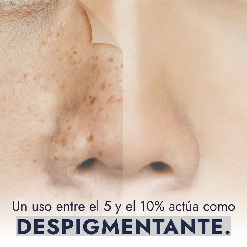 Hebbe - Niacinamida Pura para Rejuvenecimiento y Cuidado de la