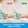 Ingrown Toenail Treatment Drops - Plant-Based Softener Solution