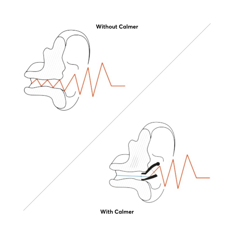 Flare Calmer Soft – Ear Plugs Alternative – Reduce Annoying