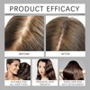Hair Serum Bundle Set, Thinning Hair with Plant-Based Actives, Volumizing