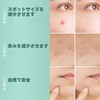 ACOTYE Comedone Patches, 210 Pieces, Acne Patches, Tea Tree Oil,