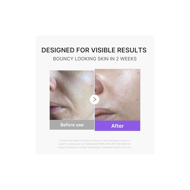 Medicube Mini Booster Pro Plus Dispositivo Facial Piel Radiante Calmante
