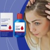 Champú Antidandico, Pérdida De Cabello, Control De Aceite