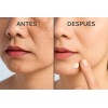 Crema Aclarante, Antiarrugas, Quita Mancha Acido Hialurónico