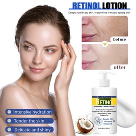 Retinol Body Lotion, Retinol Firming Cream for Loose Skin, Nourishing Skincare Body Cream with Cocount Oil and Vitamin E, Soothing Skin Moisturiser for Dry and Aging Skin (300ml)