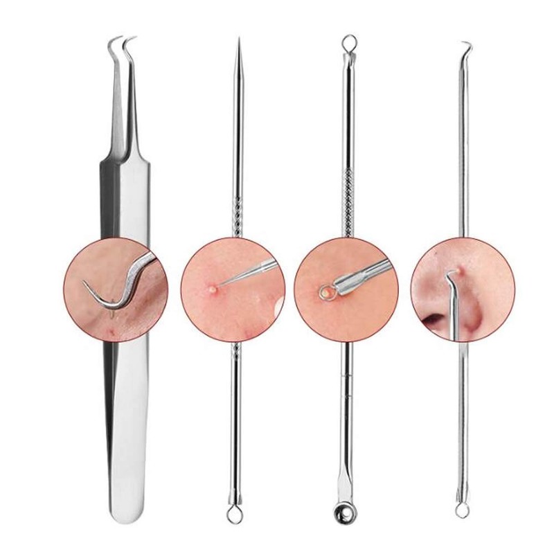 KAV Comedone Extractor Kit 5-Piece Blackhead Remover Tool Set with