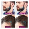 Derma Roller 0.25-0.5 Mm Facial Cabello O Rodillo Para Barba