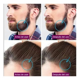 Derma Roller 0.25-0.5 Mm Facial Cabello O Rodillo Para Barba