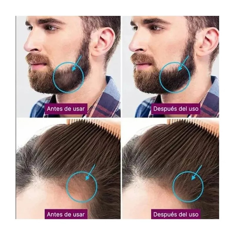 Derma Roller 0.25-0.5 Mm Facial Cabello O Rodillo Para Barba