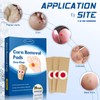 24 Count Corn Removal Pads for Feet and Toe, Corn